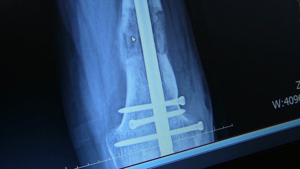 Konyalı Osman İyigökler'in ayakkabı hasreti 31 yıl sonra dindi