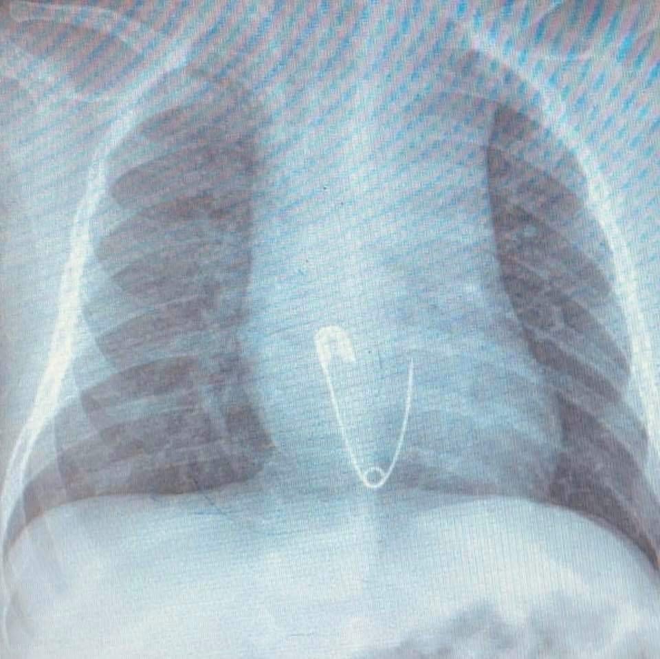 Çocuklarınızın ağzına dikkat edin! Sizin de başınıza gelebilir