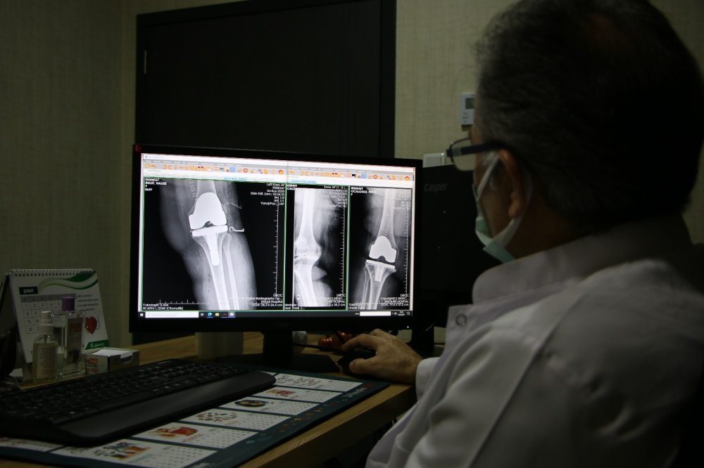 Eklem kireçlenmelerine dikkat! Ciddi sorunlara neden oluyor