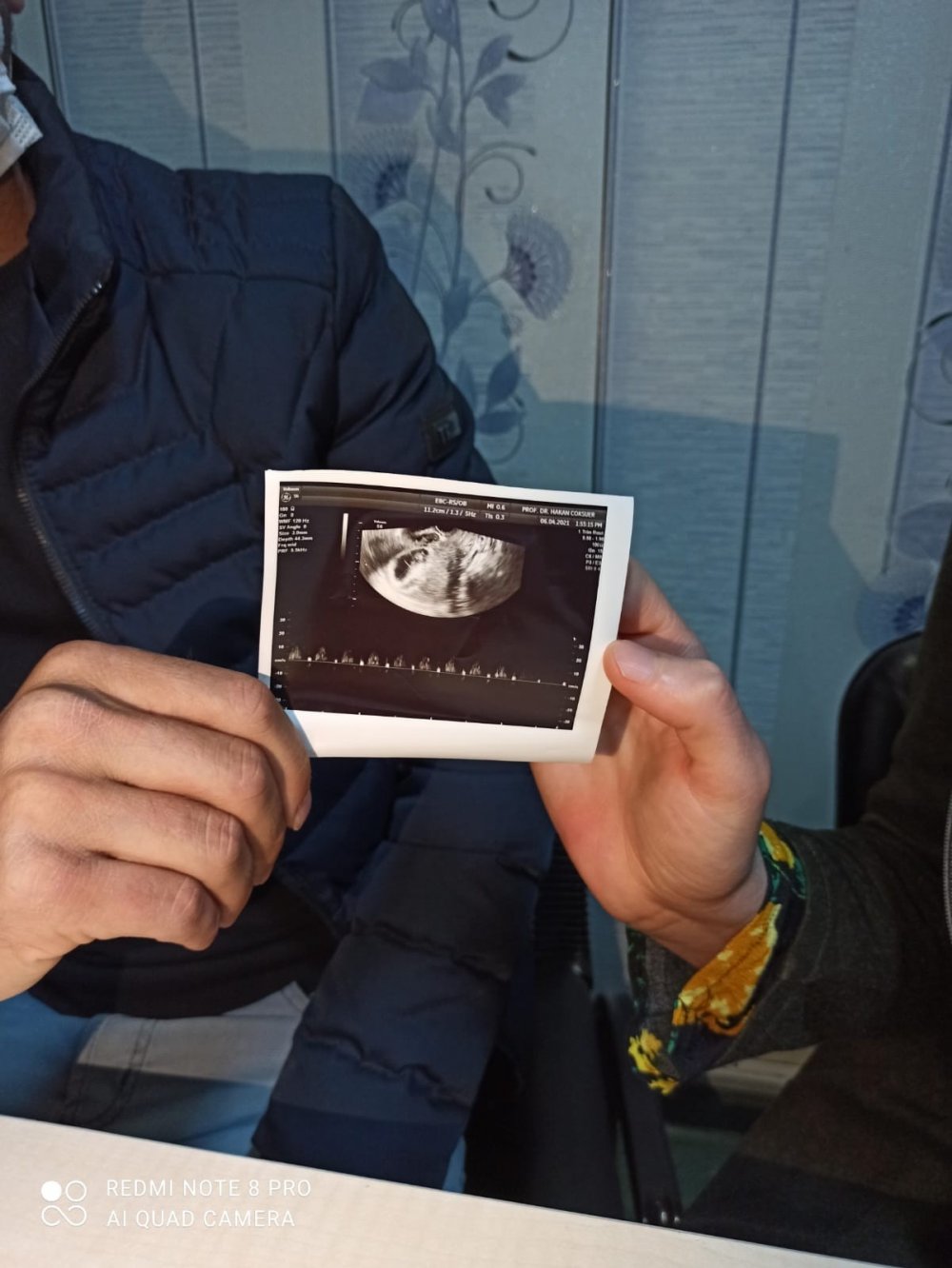 Çocuk sahibi olamayan aileler için yeni yöntem! İkili kombine tedavisi