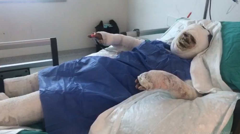 Mersin'de vahşet! Üzerine benzin döküp yaktı