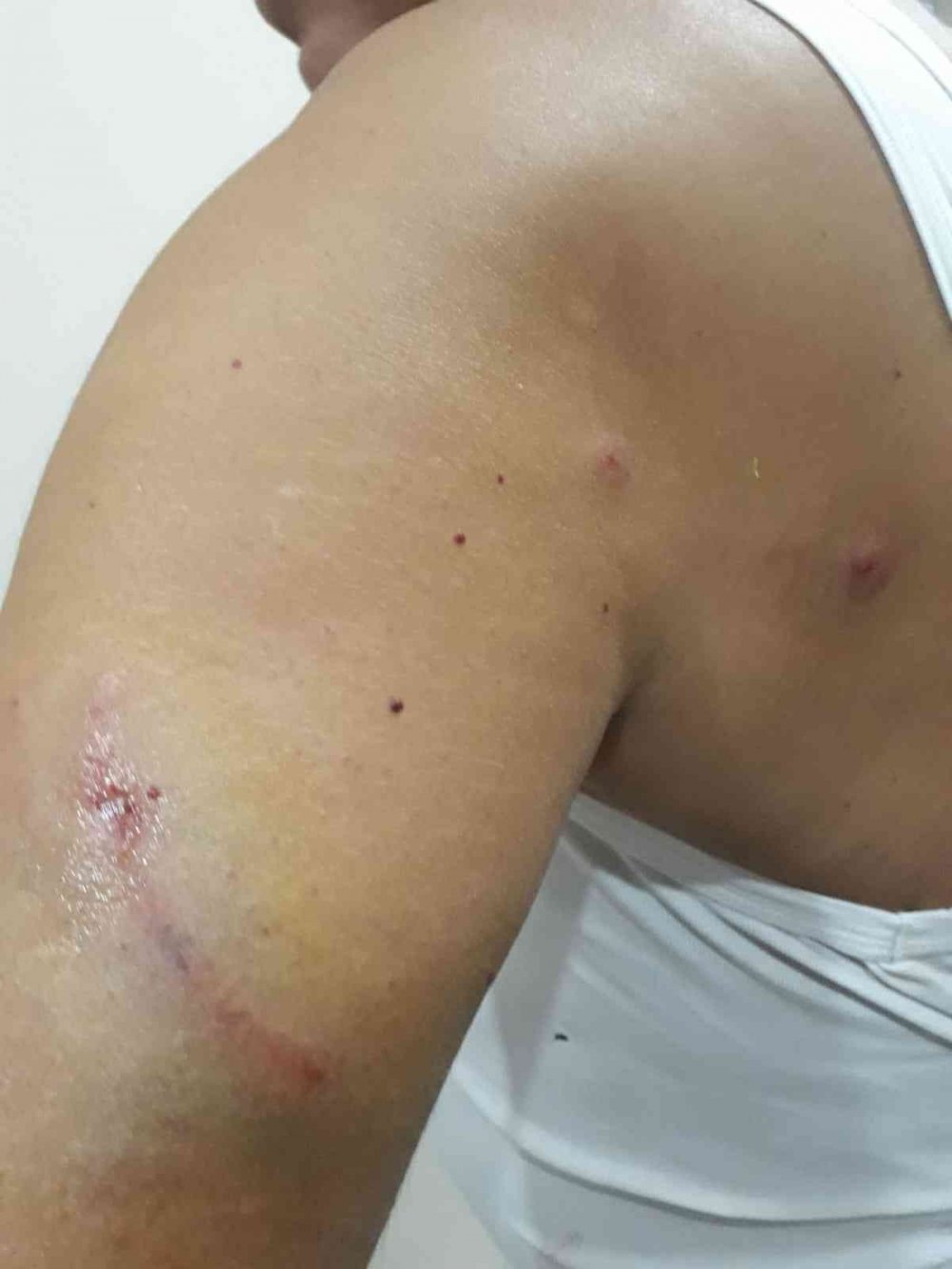 Sokak köpekleri yine dehşet saçtı! Saldırıya uğrayan yaşlı adamı esnaf kurtardı