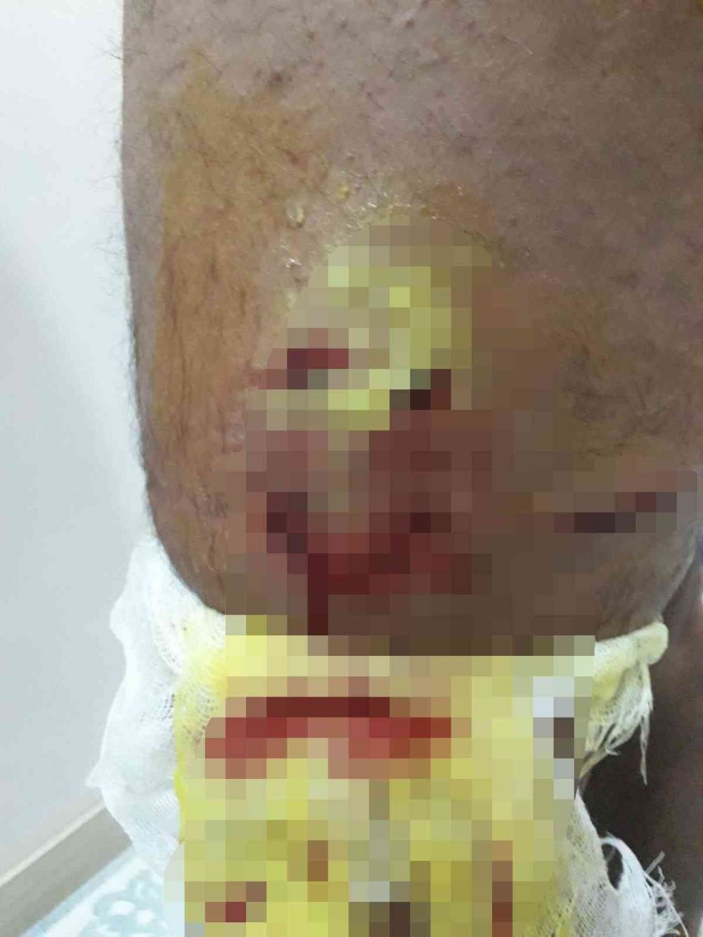 Sokak köpekleri yine dehşet saçtı! Saldırıya uğrayan yaşlı adamı esnaf kurtardı