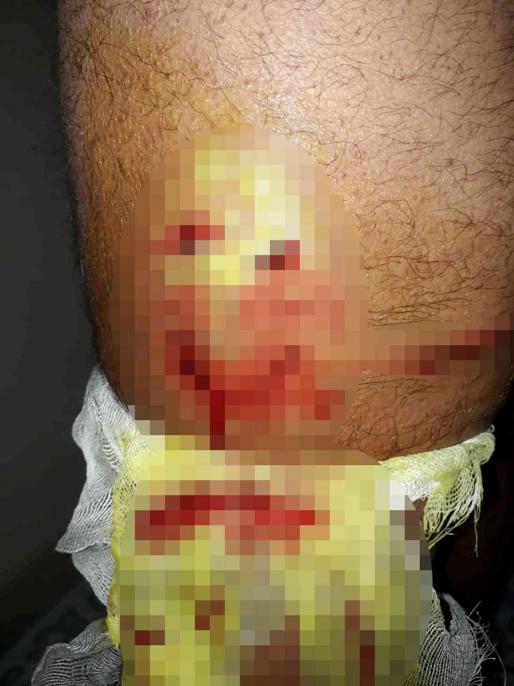 Sokak köpekleri yine dehşet saçtı! Saldırıya uğrayan yaşlı adamı esnaf kurtardı