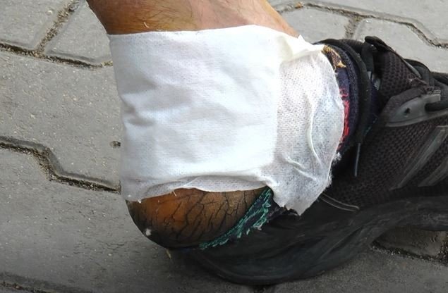 Gaziantep’te bir pitbull vakası daha! Tartıştığı adamın üstüne köpeğini saldı