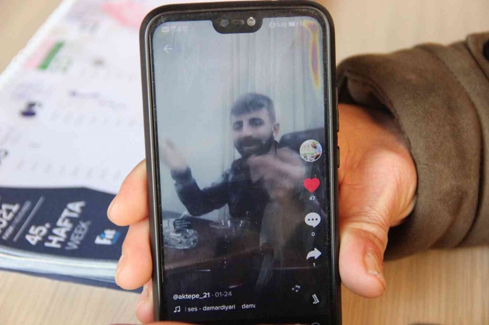 Manisa'da yaşayan 29 yaşındaki gencin hastalığının adı BK virüs