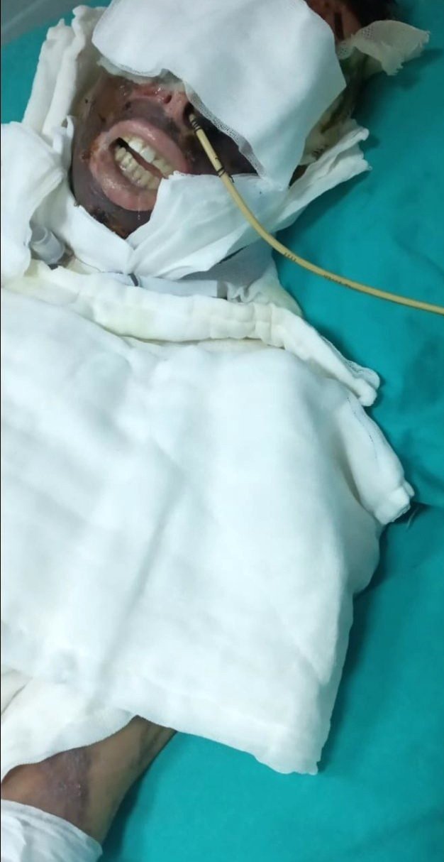 Yasemin Uzunçelebi'nin hayatını karartan Mehmet Yıldız'a 20 yıl hapis istendi