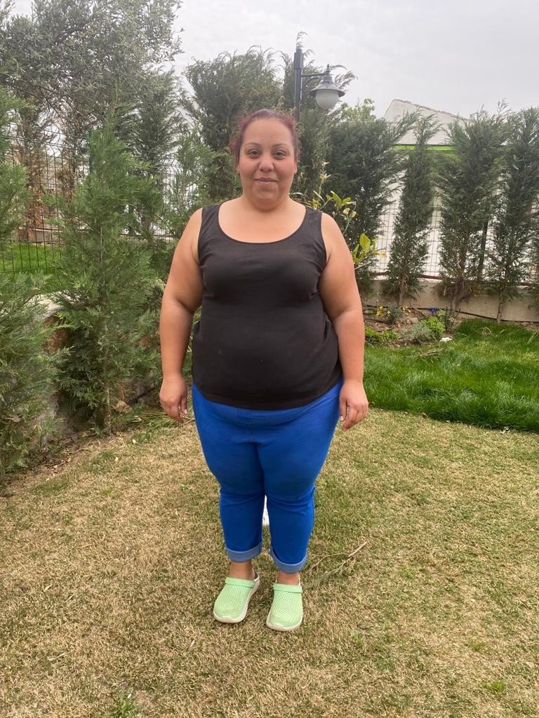 İki ayağı bir paçasına girdi! Yıllarca kilolarıyla yaşıyordu