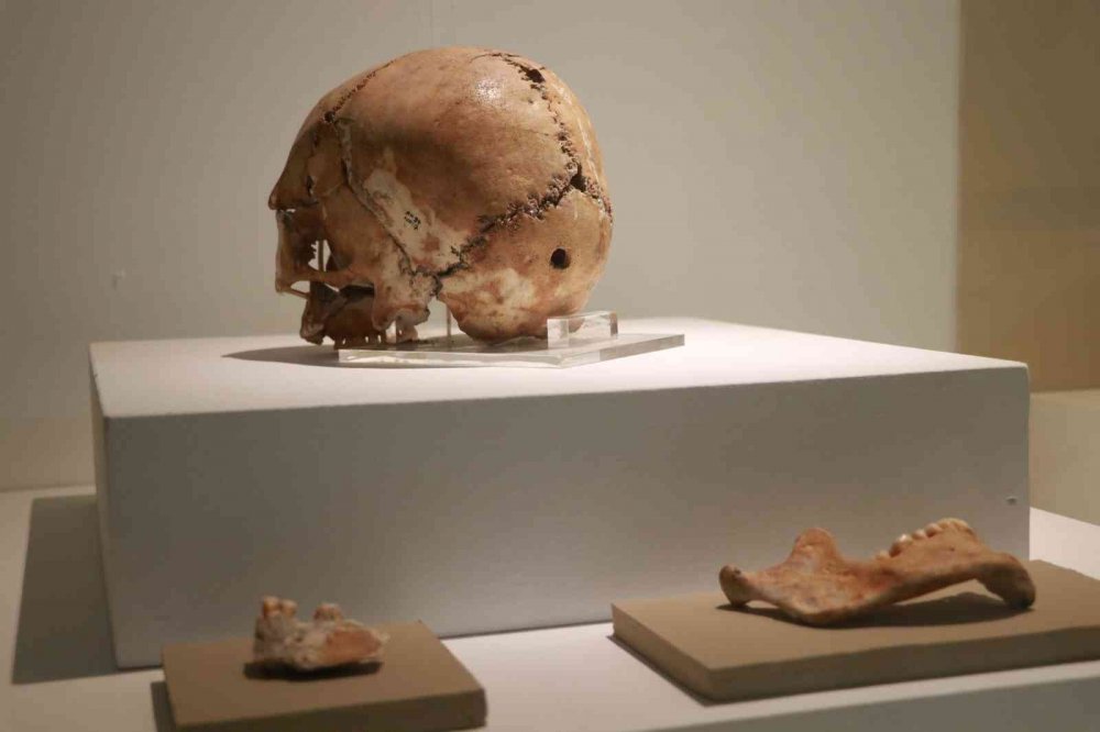 Aksaray'da bulunan 10 bin 500 yıl kafatasının sırrı ne?