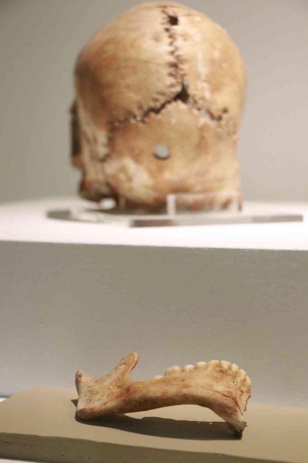 Aksaray'da bulunan 10 bin 500 yıl kafatasının sırrı ne?