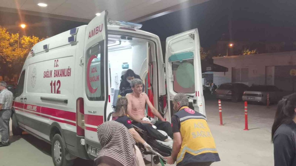 Fabrikada üzerine asit püsküren işçinin vücudunun yüzde 60'ı yandı