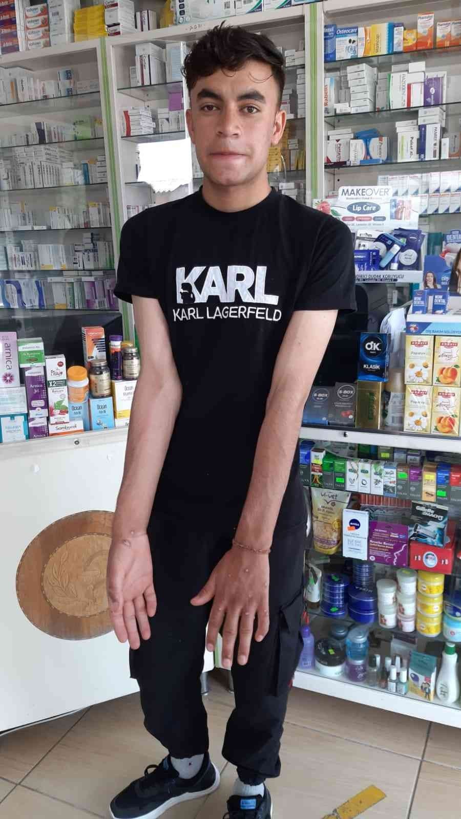 İstanbul'da 'maymun çiçeği' iddiası! Eczaneye gitti karantinaya alındı