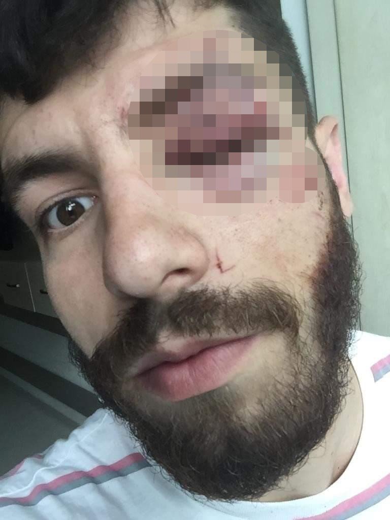 Vicdansız patron! Sigortasız çalıştırdığı işçisine maaşını da vermedi! Bardakla saldırdı..