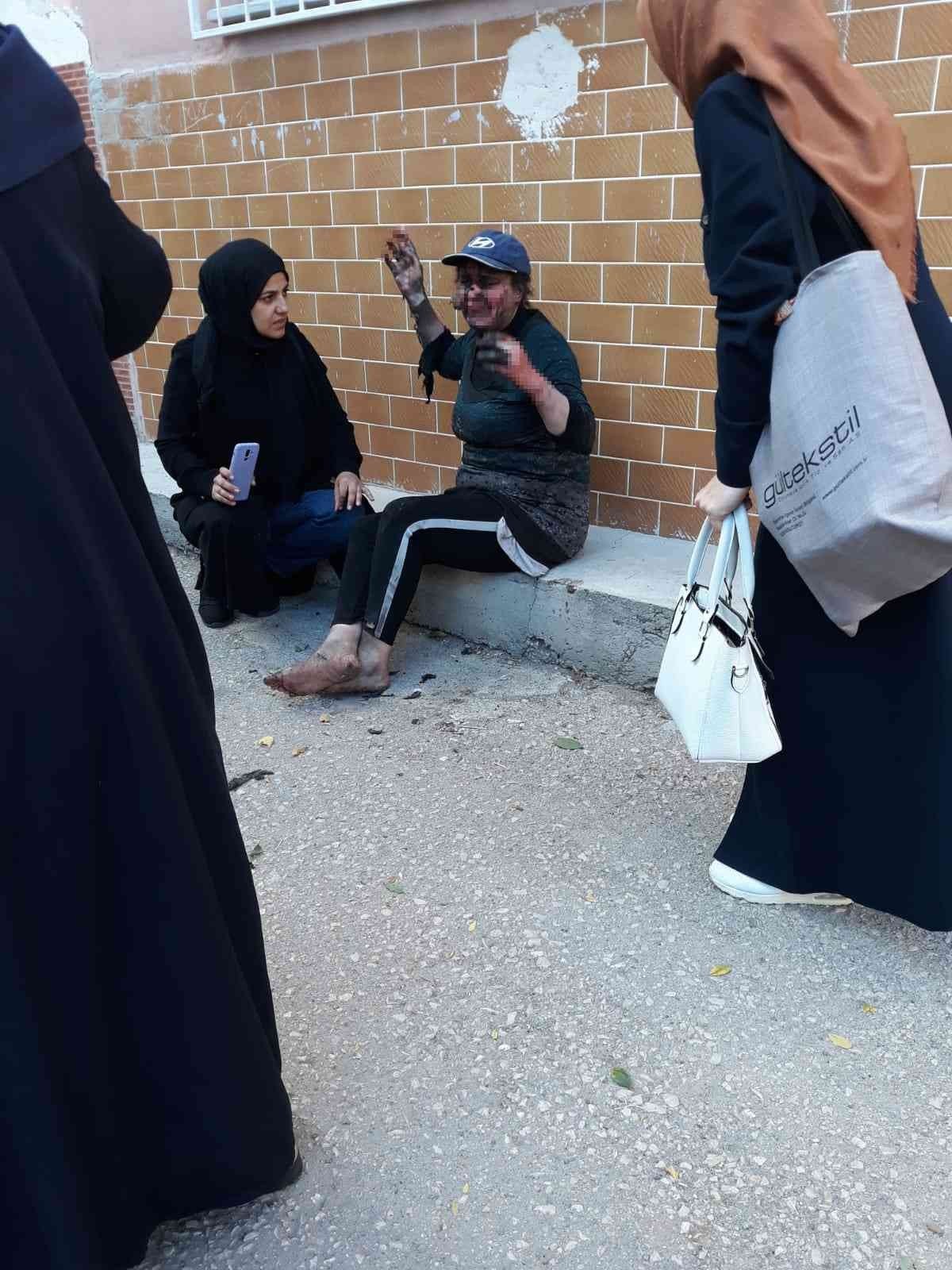 Mutfakta harlayan yağ sonucu bir kişi yanarak yaralandı
