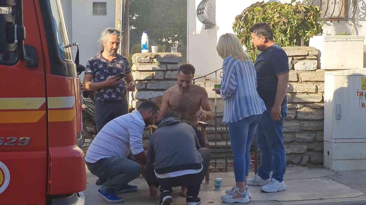 Yangını söndürmeye çalışırken yaralandı