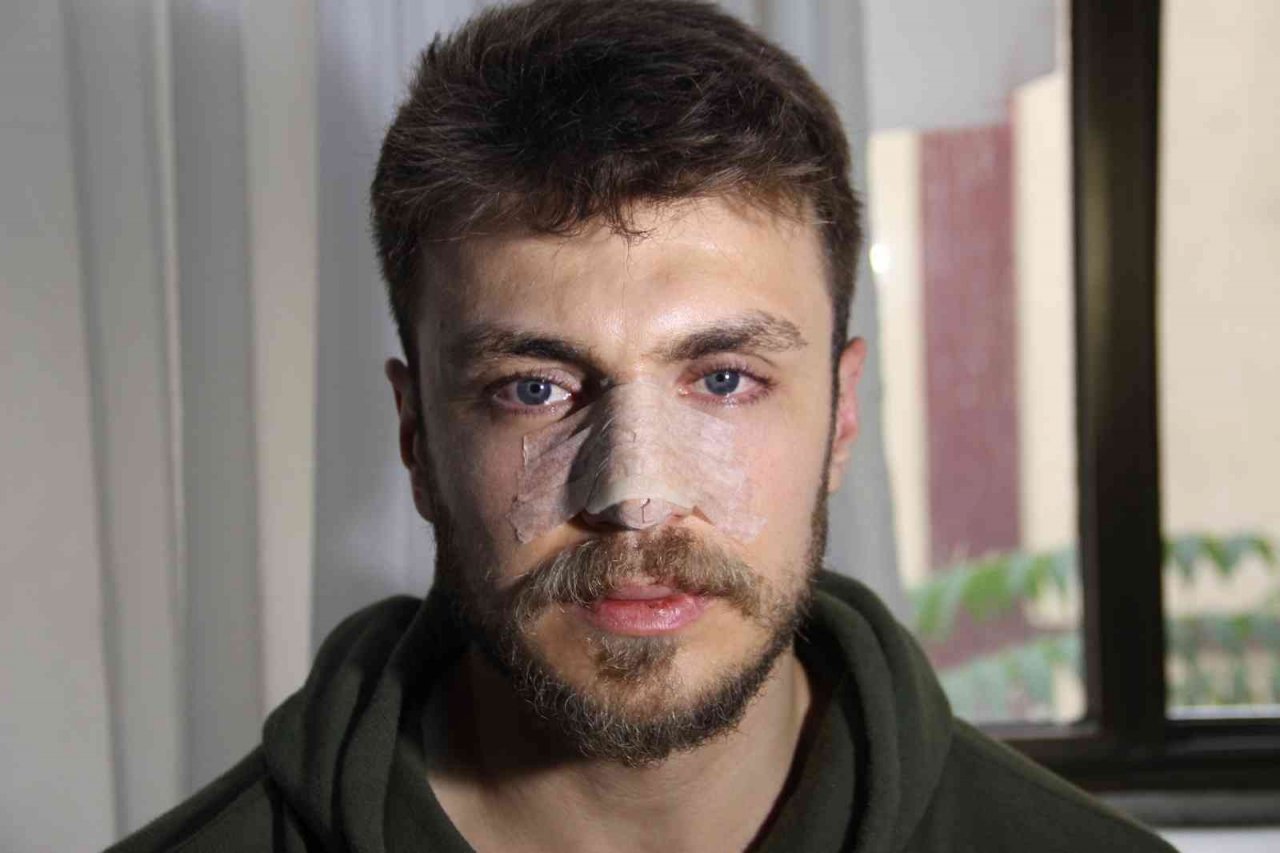 Doktorun burnunu kırarak güvenlik görevlisini de darp eden şüpheli adliyede