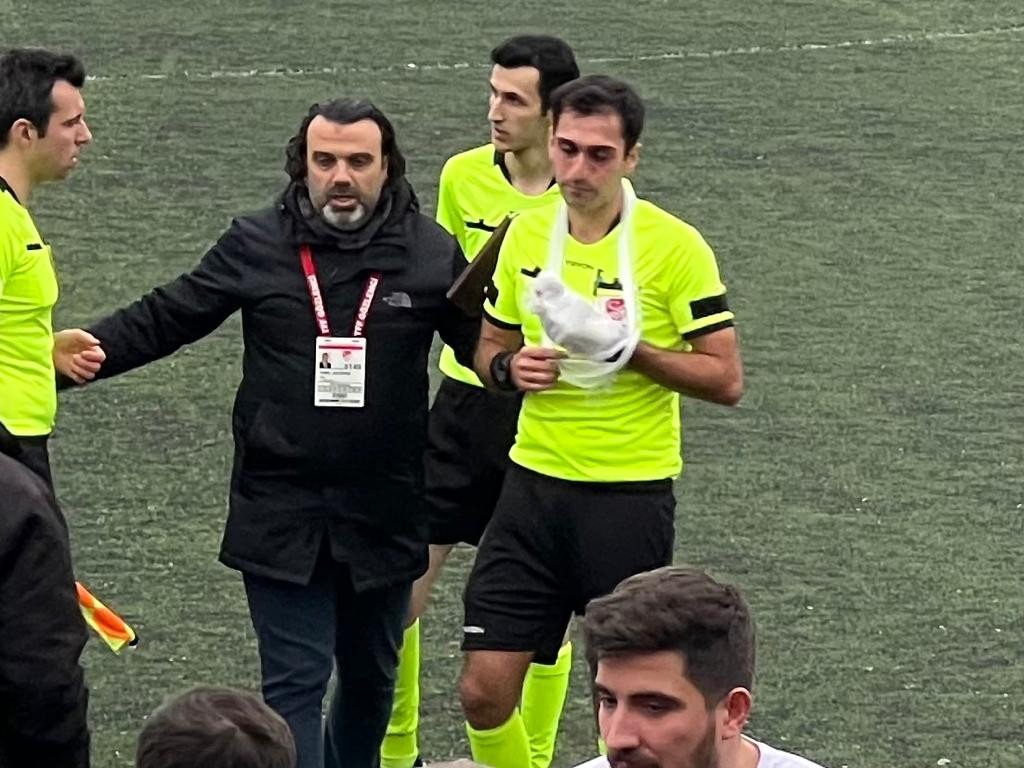 Sakatlanan hakem elinde bandajla maçı yönetti