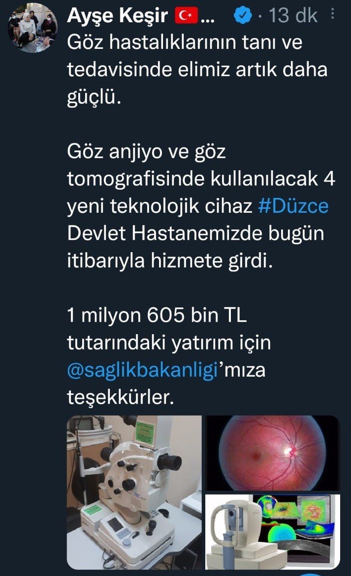 Düzce’ye sağlık alanında 4 yeni teknolojik cihaz