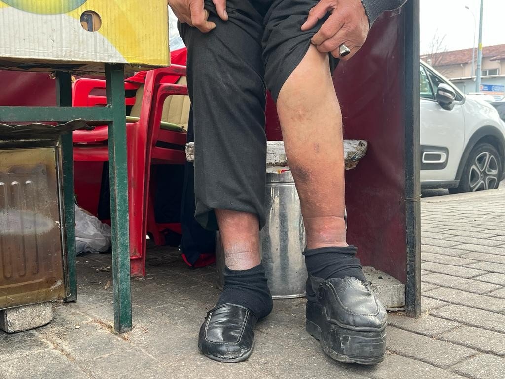 Bacakları protez olan simitçinin ‘elim kolum’ dediği aracını çaldılar