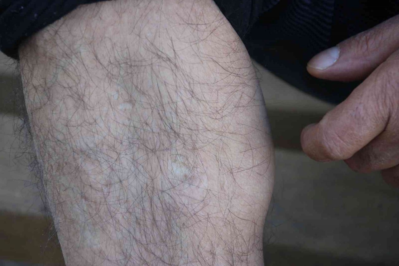 Dicle Üniversitesinde 1993’teki bombalı saldırının izleri yemekhane tezgahında