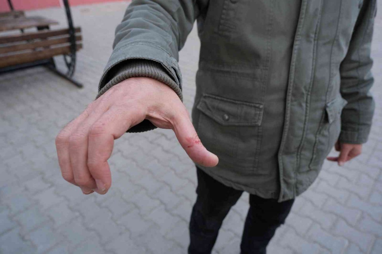 Köpeklerin saldırısına uğrayan bir kişi düşerek yaralandı