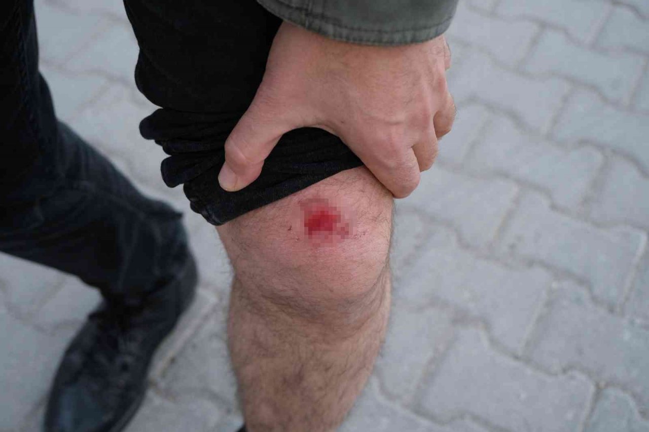 Köpeklerin saldırısına uğrayan bir kişi düşerek yaralandı