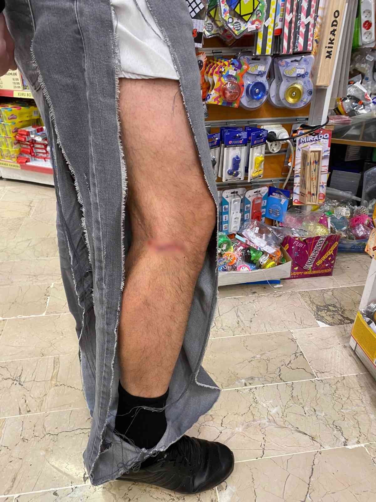 Çankaya’da başıboş köpekler vatandaşın kıyafetlerini parçaladı