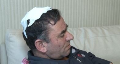 Davalı yeğen, amcasının kafa derisini yüzdü