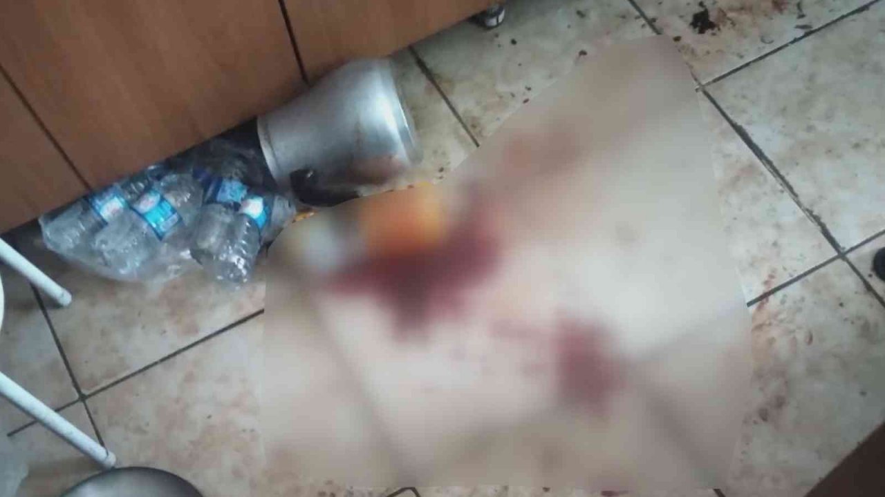 Davalı yeğen, amcasının kafa derisini yüzdü