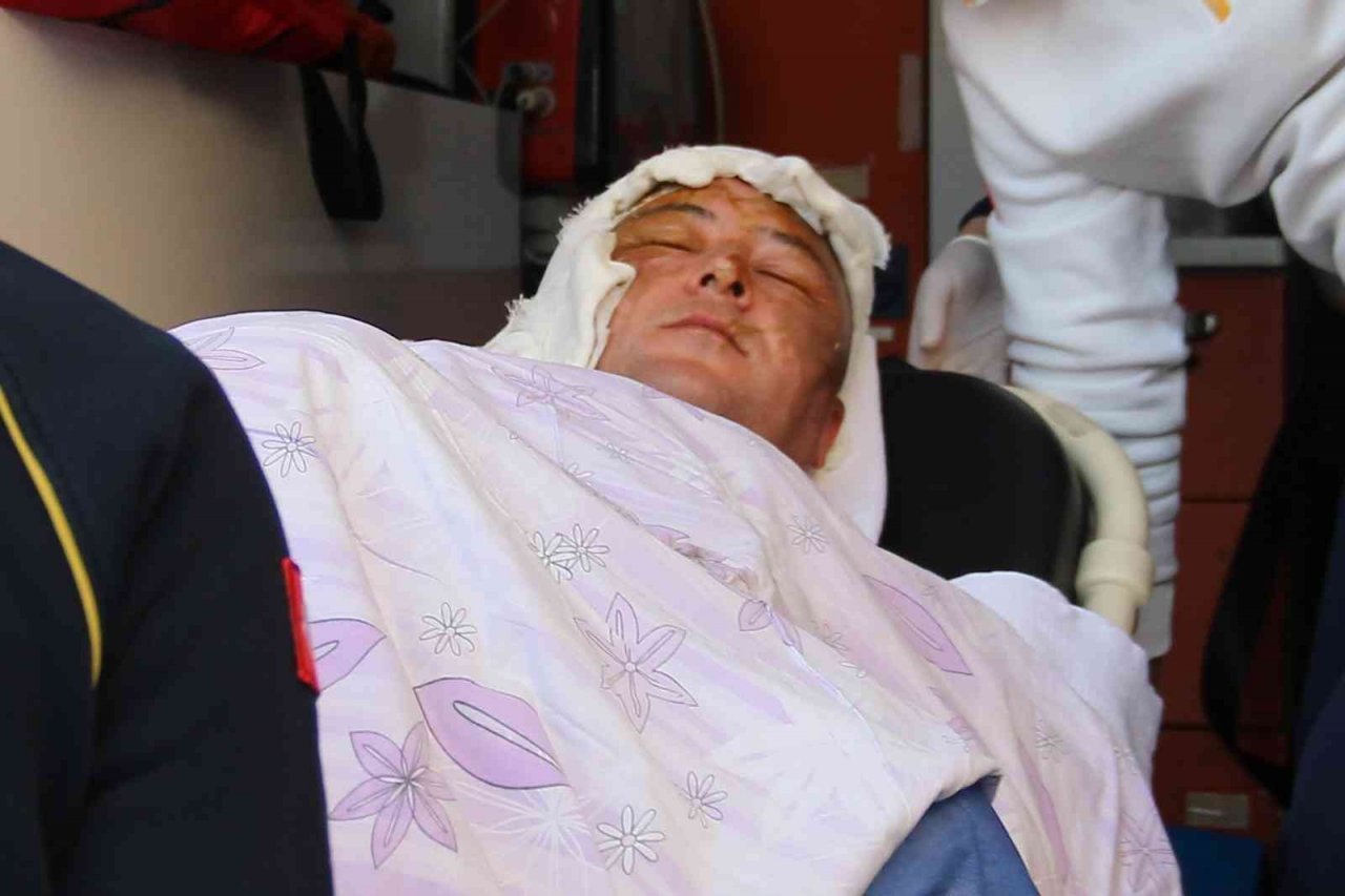 Tarım Kredi Süt Ürünleri fabrikasındaki kazada ağır yaralanan işçi, İzmir’de tedavi altında