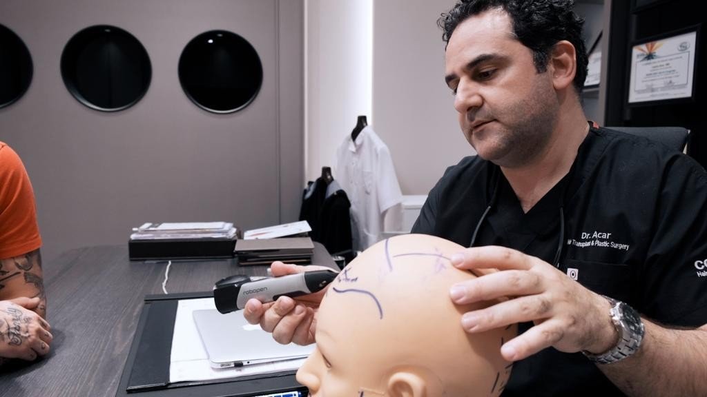 Dr. Levent Acar: "Türkiye saç ekiminde zirvede"