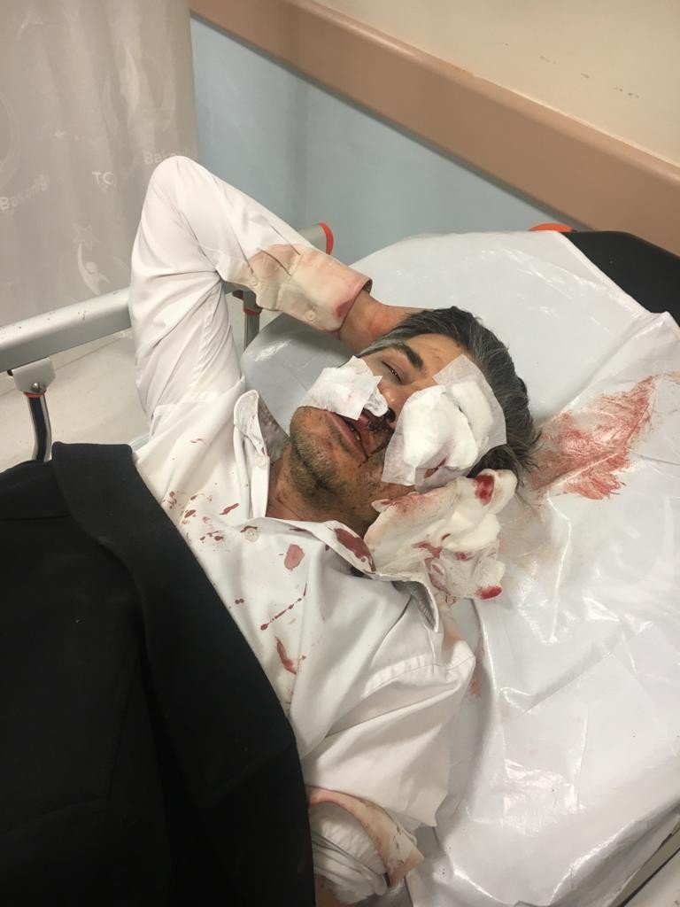 Öldüresiye dövüp "kendi kendine yaptı" dedi