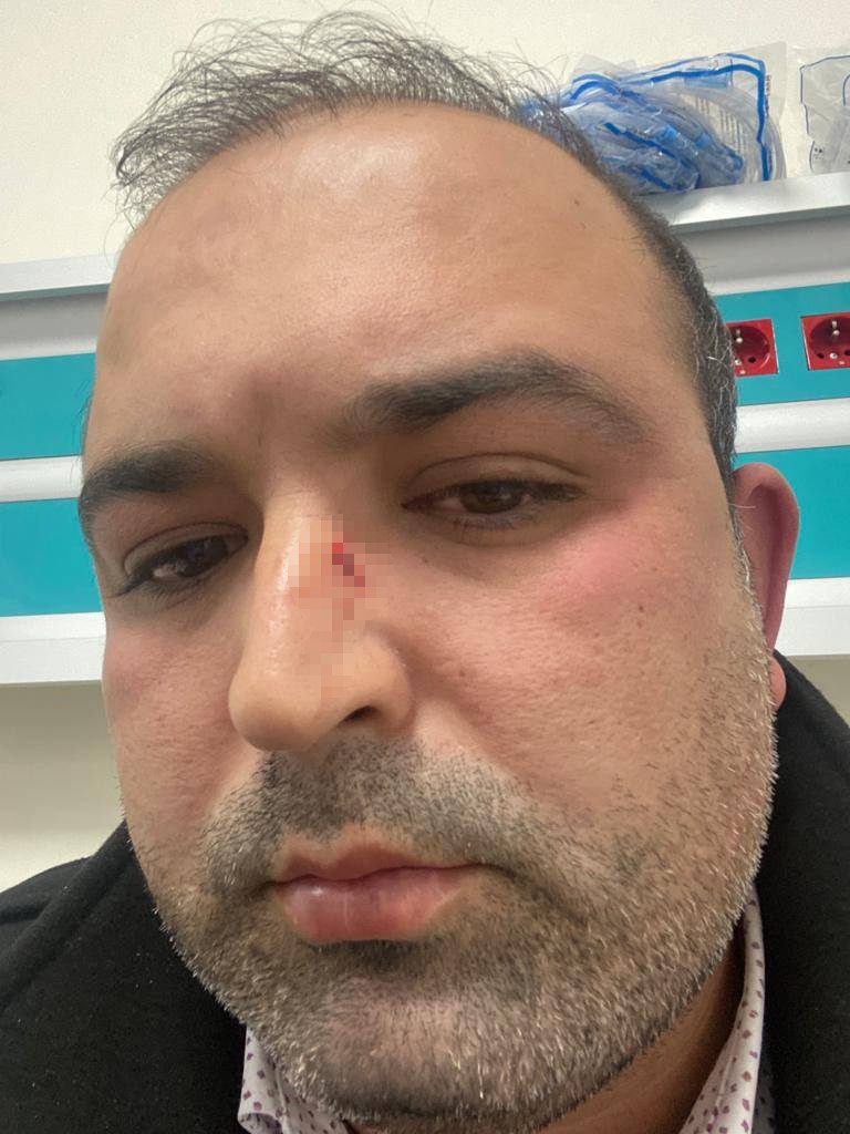 Arkadaşıyla yemeğe giden avukat, tartıştığı müşteriler tarafından darp edildi