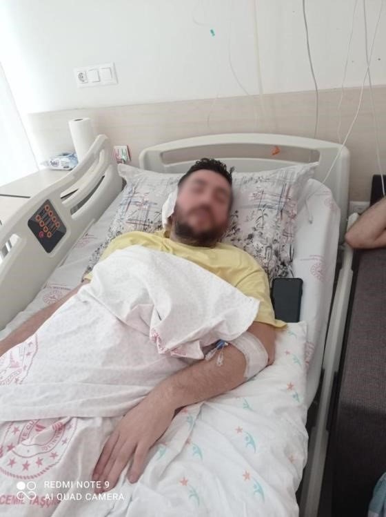 İstanbul’da baltalı oduncu dehşeti kamerada: Başına odunla vurulan genç felç kaldı