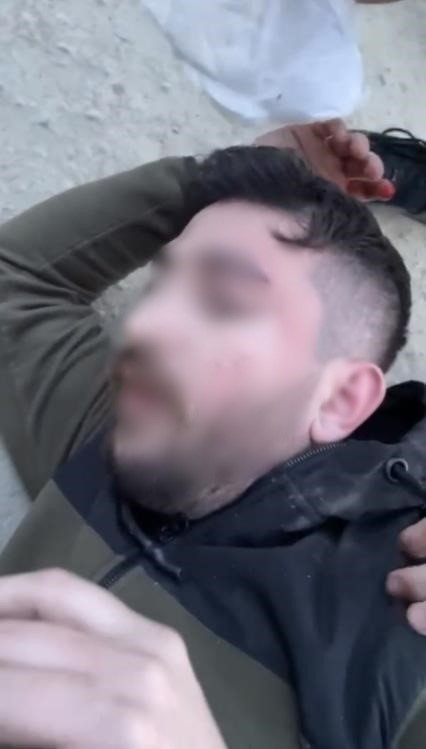 İstanbul’da baltalı oduncu dehşeti kamerada: Başına odunla vurulan genç felç kaldı