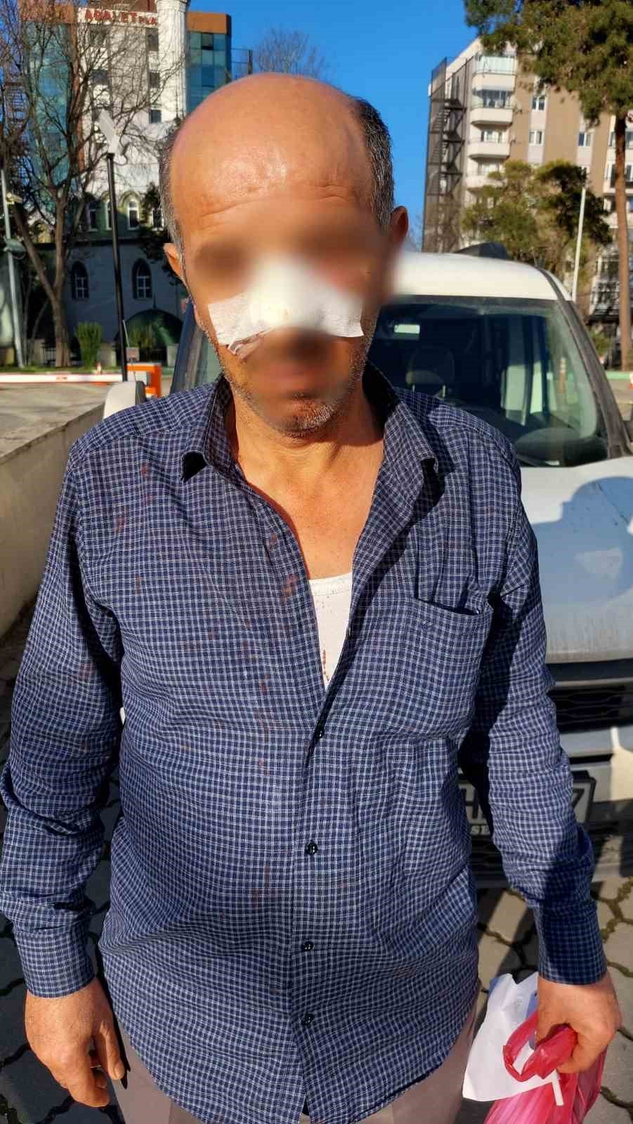 Ev sahibi-kiracı kavgasında yaralanan kiracı ve kızına ev hapsi