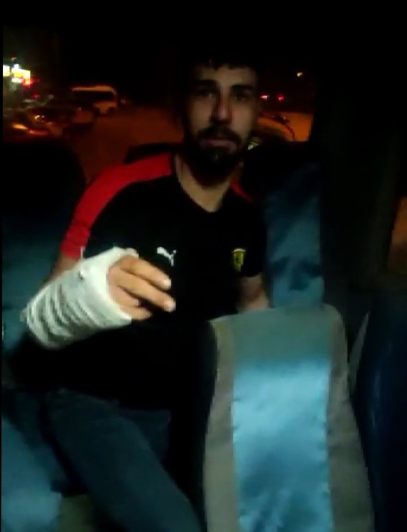 Minibüste yolculuk yaparken elini koltuğun arasına sıkıştırdı