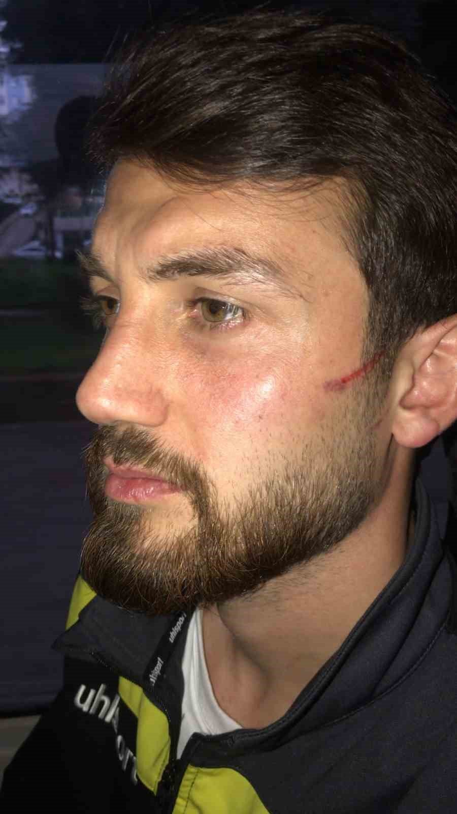 BAL ligi müsabakasında kavga