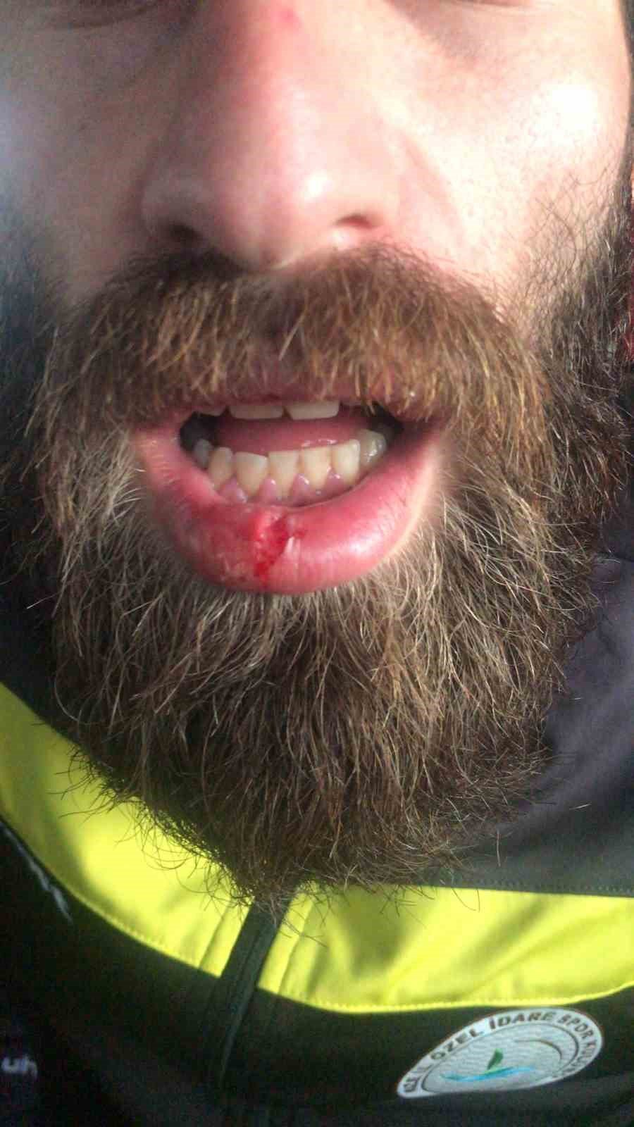 BAL ligi müsabakasında kavga