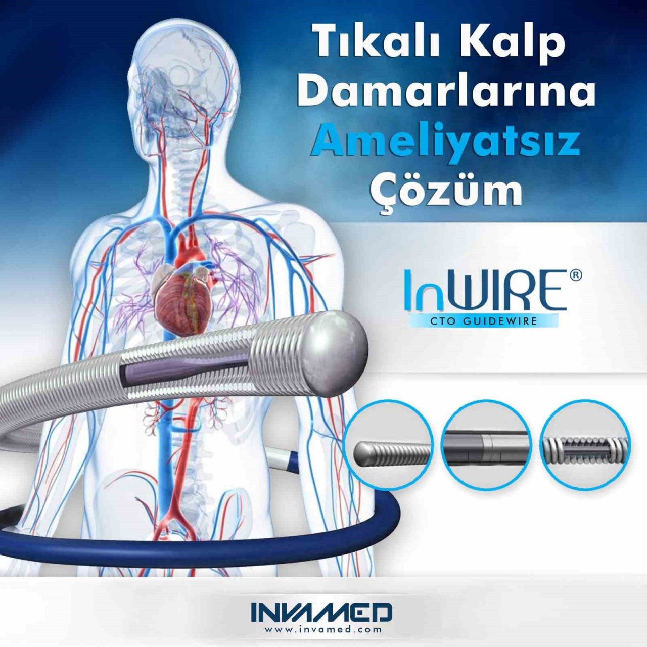 Tam tıkalı kalp damarlarına ameliyatsız çözüm