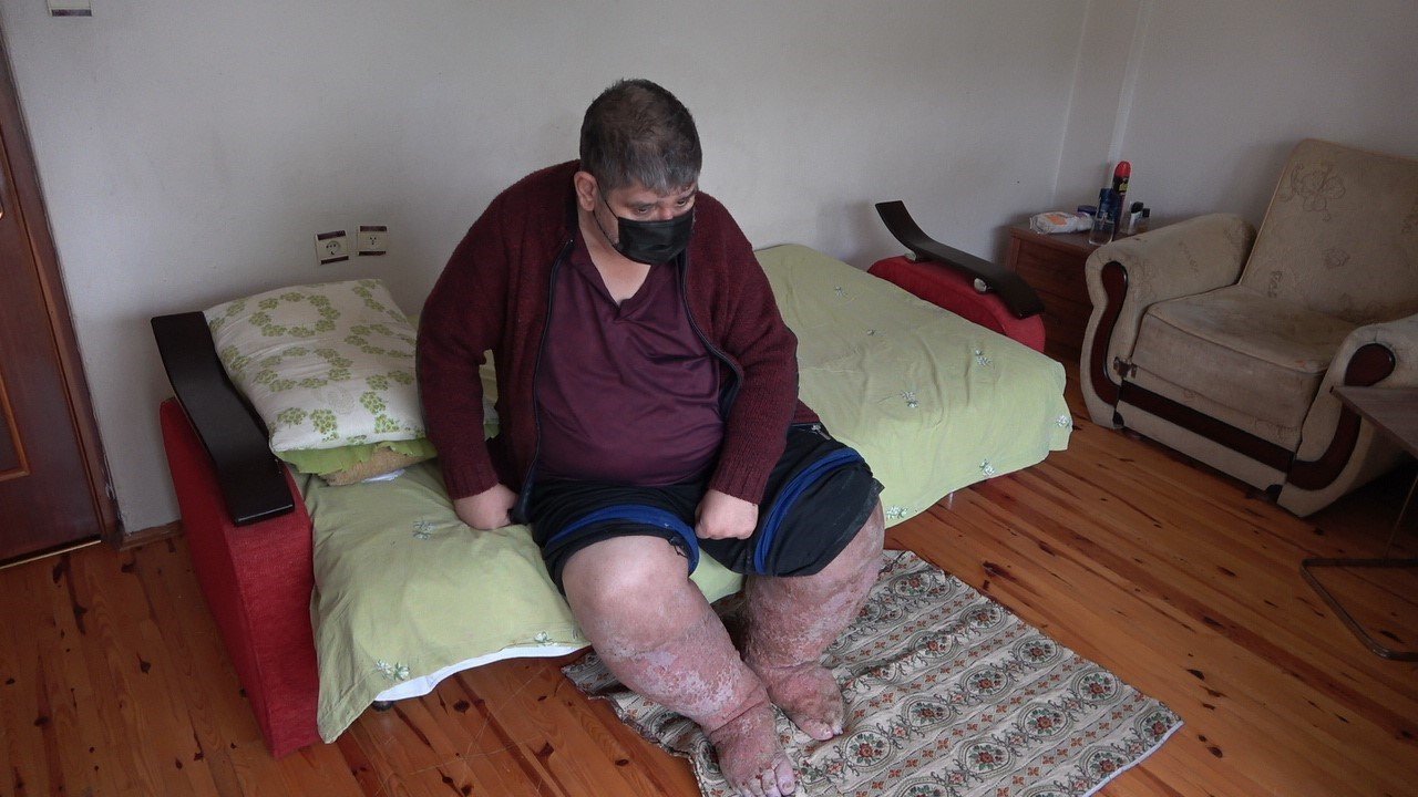 Sivrisineğin ısırdığı güvenlik görevlisi yaşama tutunamadı