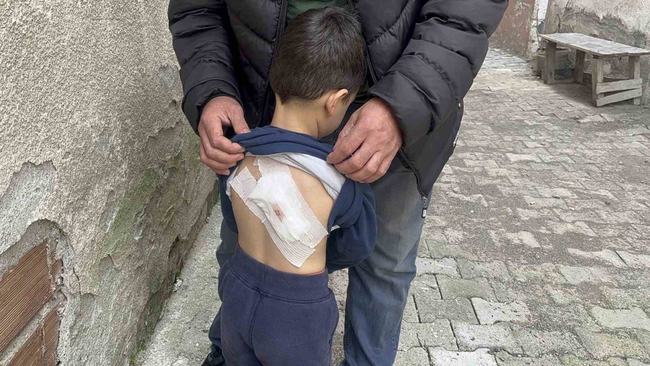 Sokak köpeklerinin saldırdığı 4 yaşındaki çocuk ölümden döndü