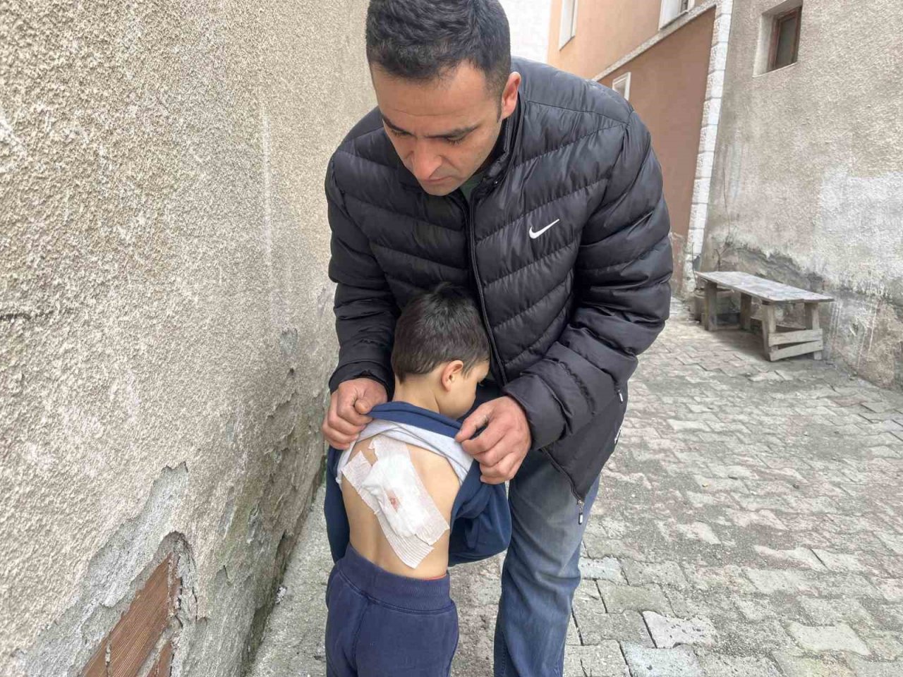 Sokak köpeklerinin saldırdığı 4 yaşındaki çocuk ölümden döndü