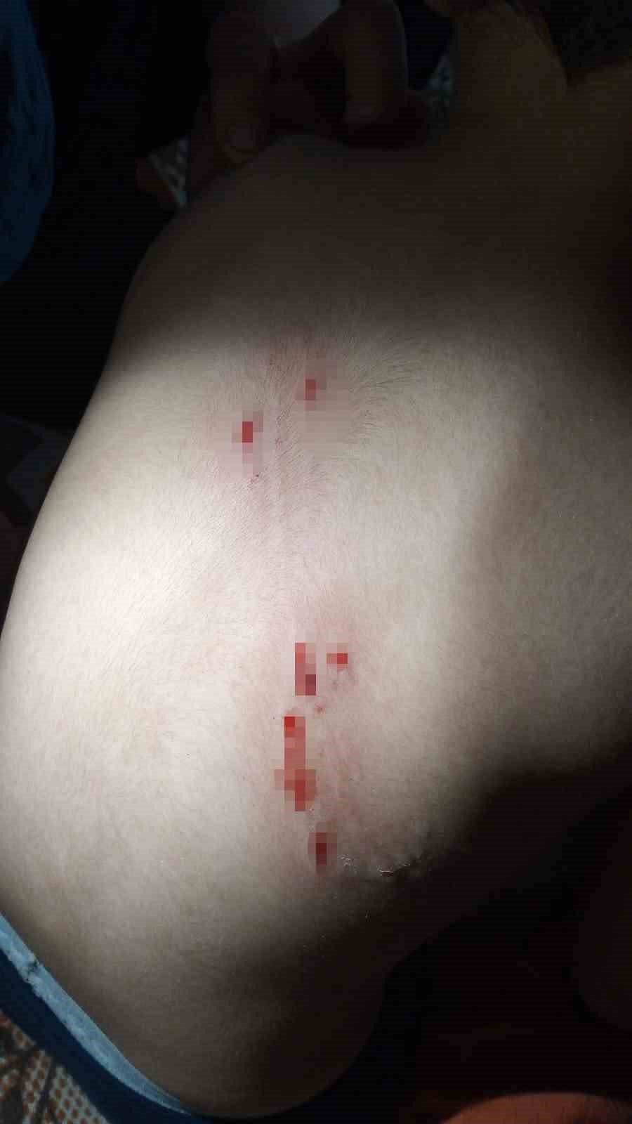 Sokak köpeklerinin saldırdığı 4 yaşındaki çocuk ölümden döndü