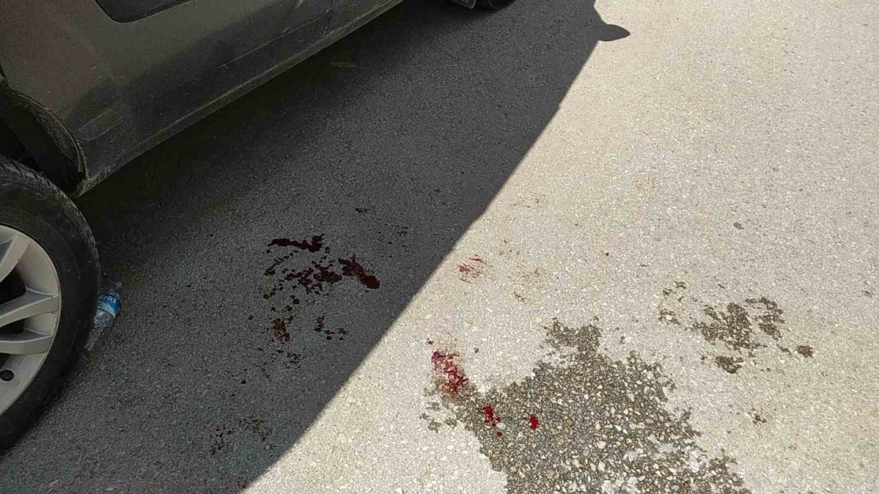 Yolun karşısına geçmeye çalışan çocuğa otomobil çarptı