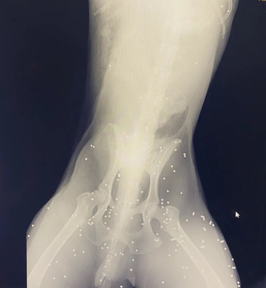 Av tüfeği ile vurulan köpeğin vücudunda 100’den fazla saçma tespit edildi