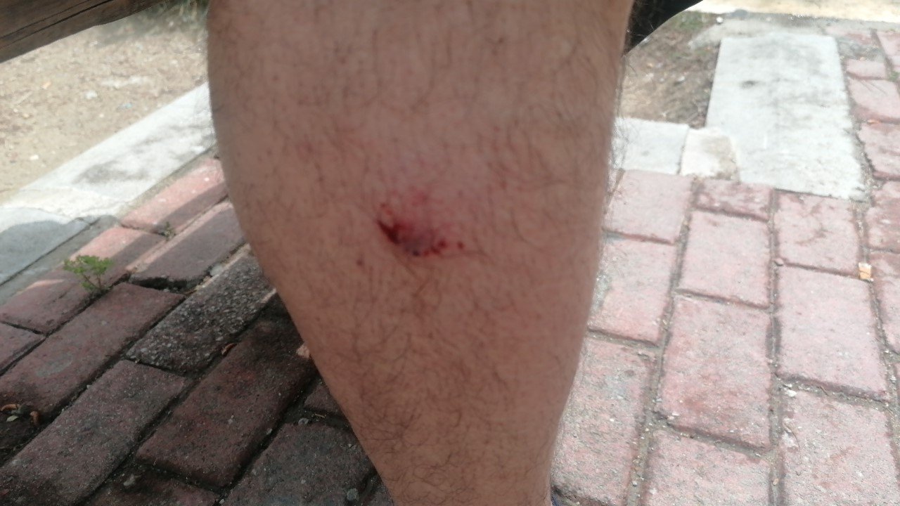 Seçmen bilgi kağıdı dağıtan muhtar, sokak köpeklerinin saldırısına uğradı