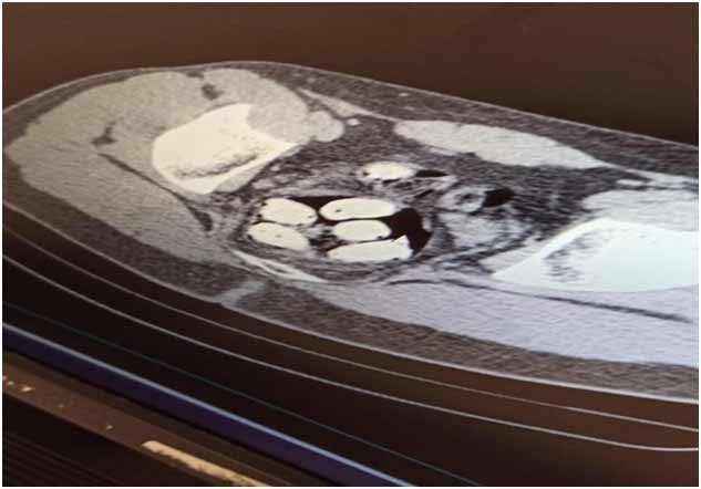 Erzincan’da jandarma ekiplerince 11 faili meçhul olayın 10’u aydınlatıldı