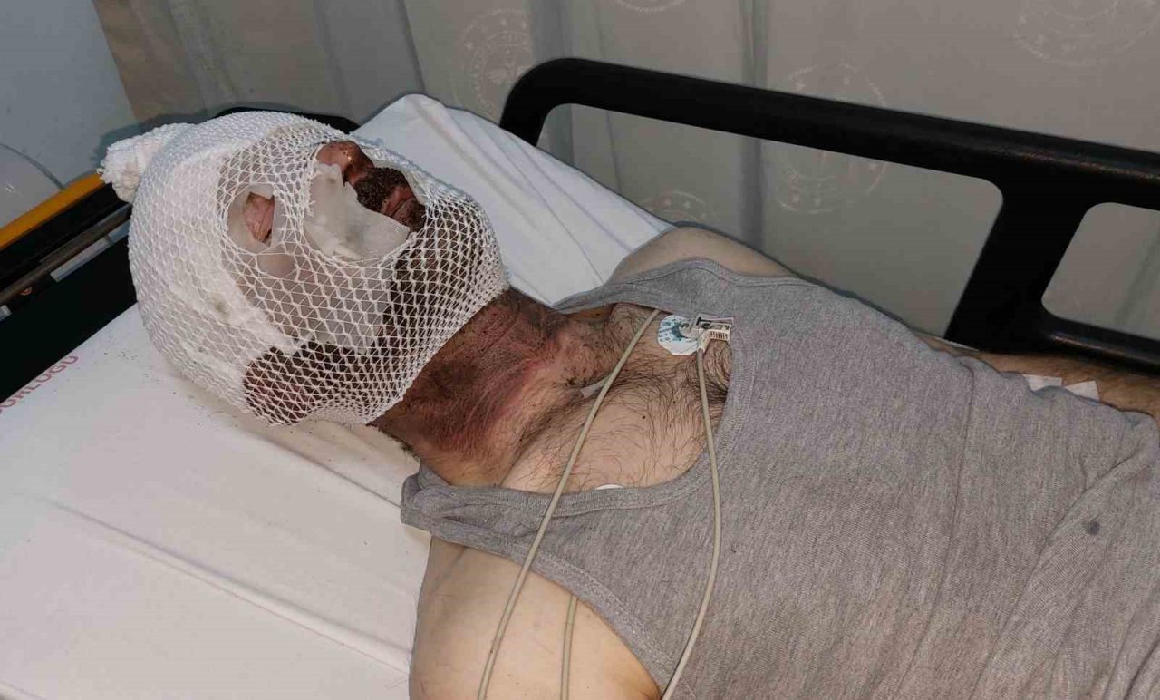 Samsunport Limanı’nda elektrik panosunda patlama: 1 yaralı