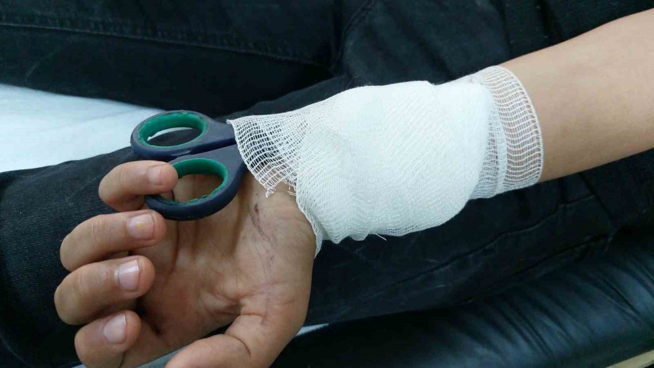Samsun’da 14 yaşındaki çocuk bileğine saplanan makasla hastaneye kaldırıldı